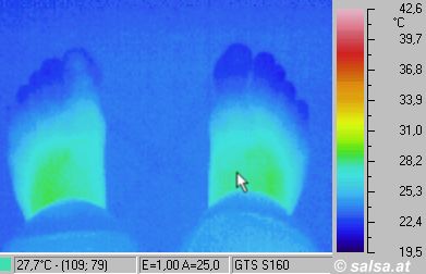 thermal image: heat radiation of feet